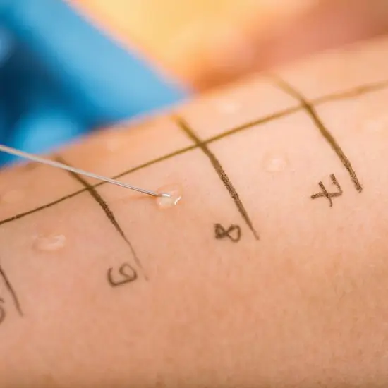 allergy panel, mold panel